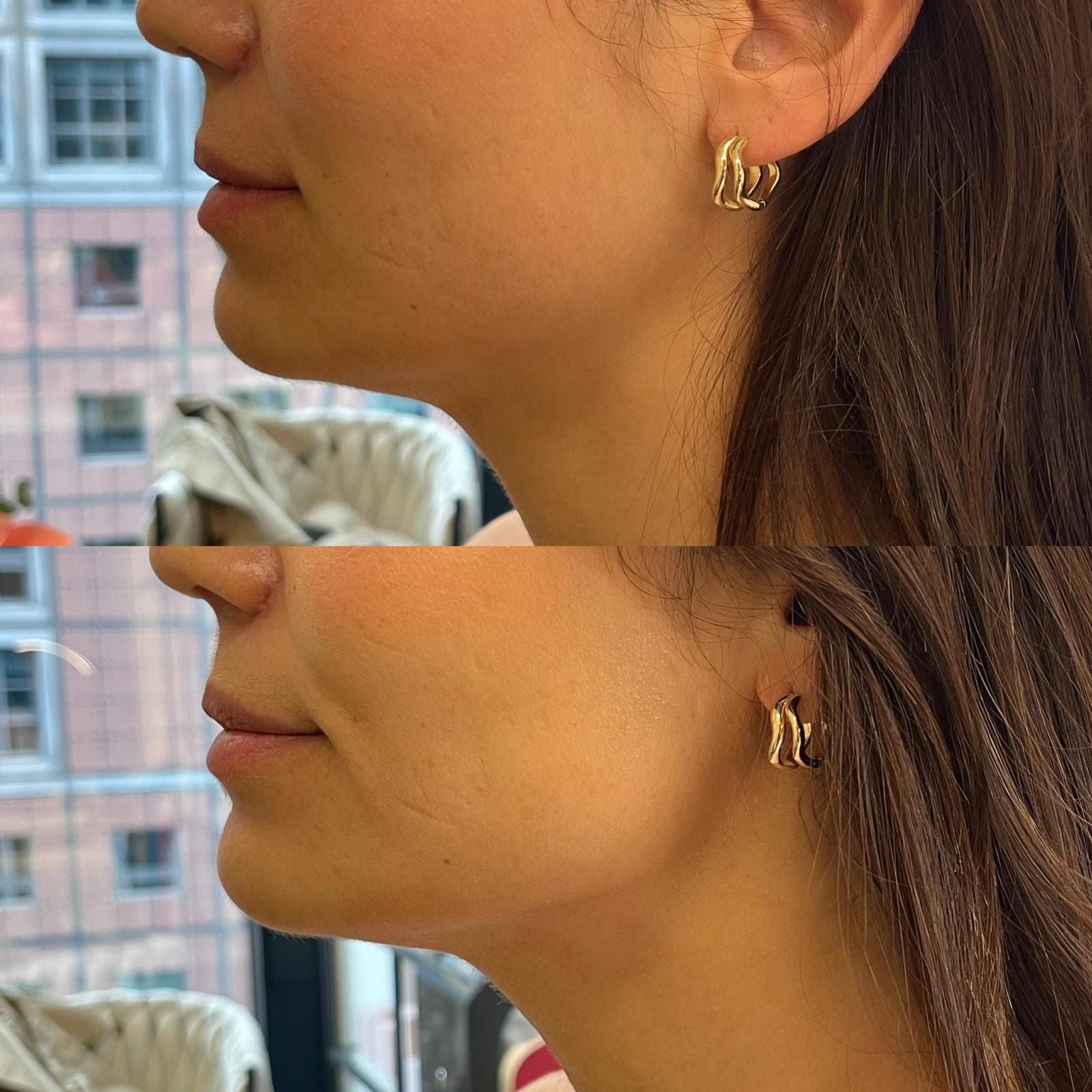 Body Shaping – Körperkonturierung bei Pocahontas Beauty