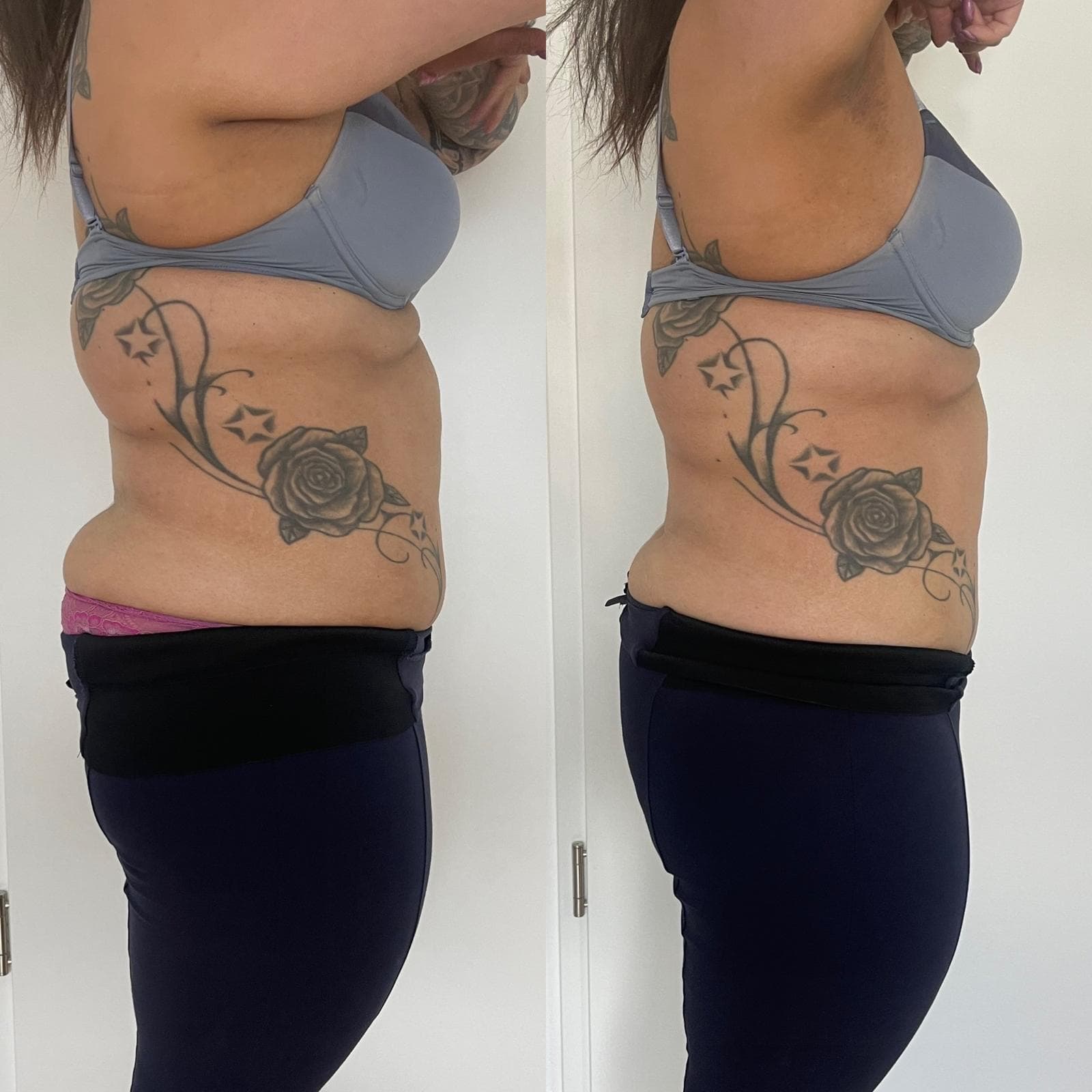 EMS Sculpter NEO Ergebnis