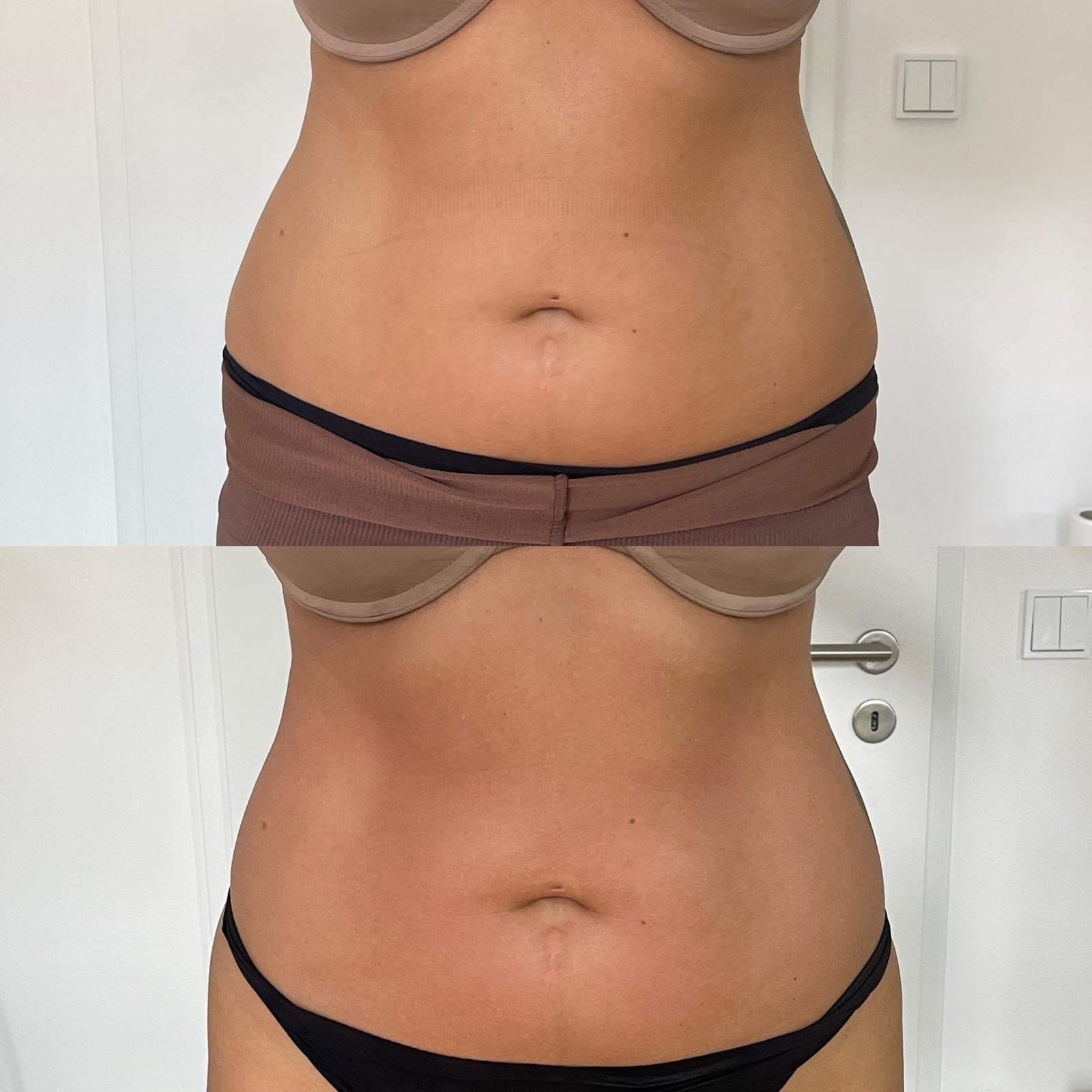 EMS Sculpter NEO – sichtbare Veränderung