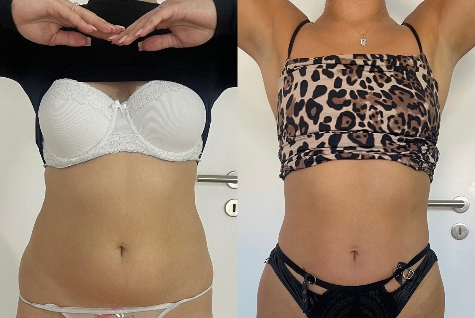 EMS Sculpter NEO – Muskelaufbau