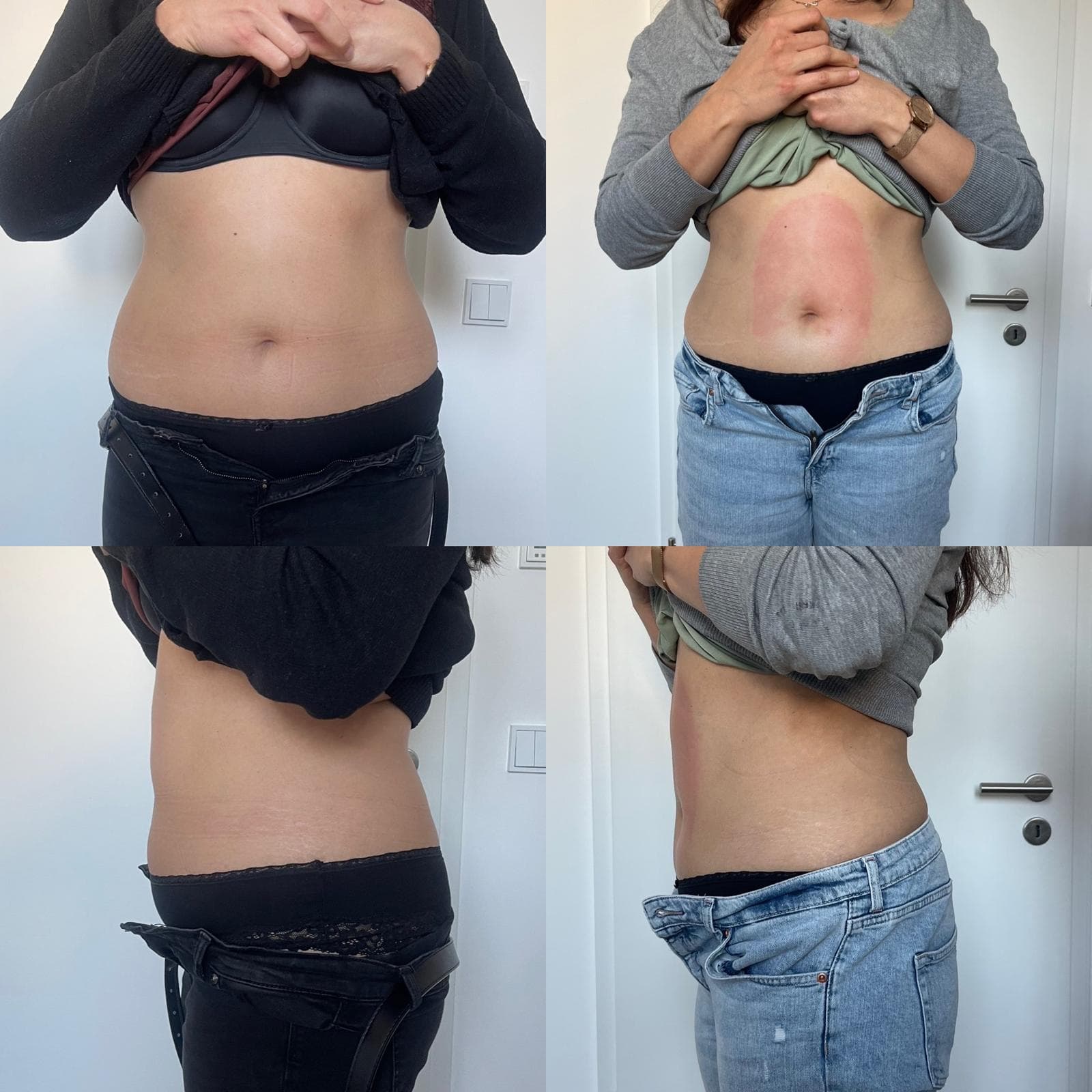 Body Shaper Ergebnis